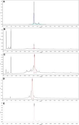 Ulmus davidiana var. japonica Extracts Suppress Lipopolysaccharide-Induced Apoptosis Through Intracellular Calcium Modulation in U937 Macrophages